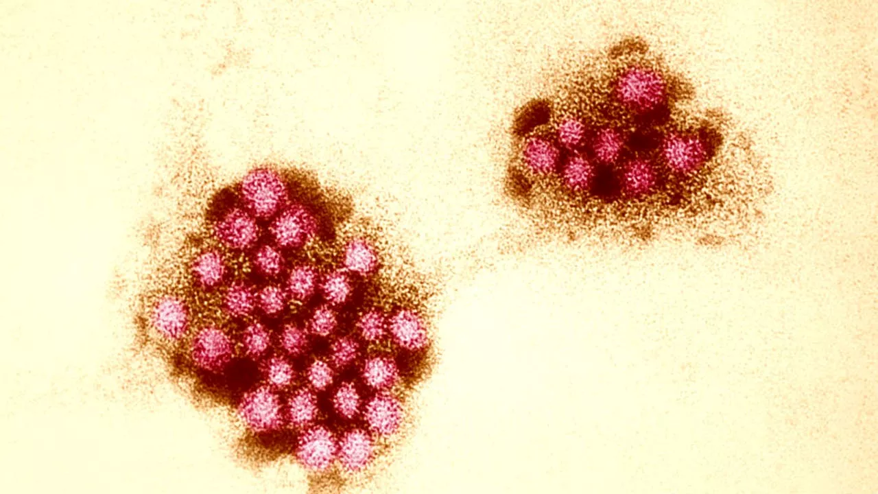 Norovirus Cases Surge in the US This Winter