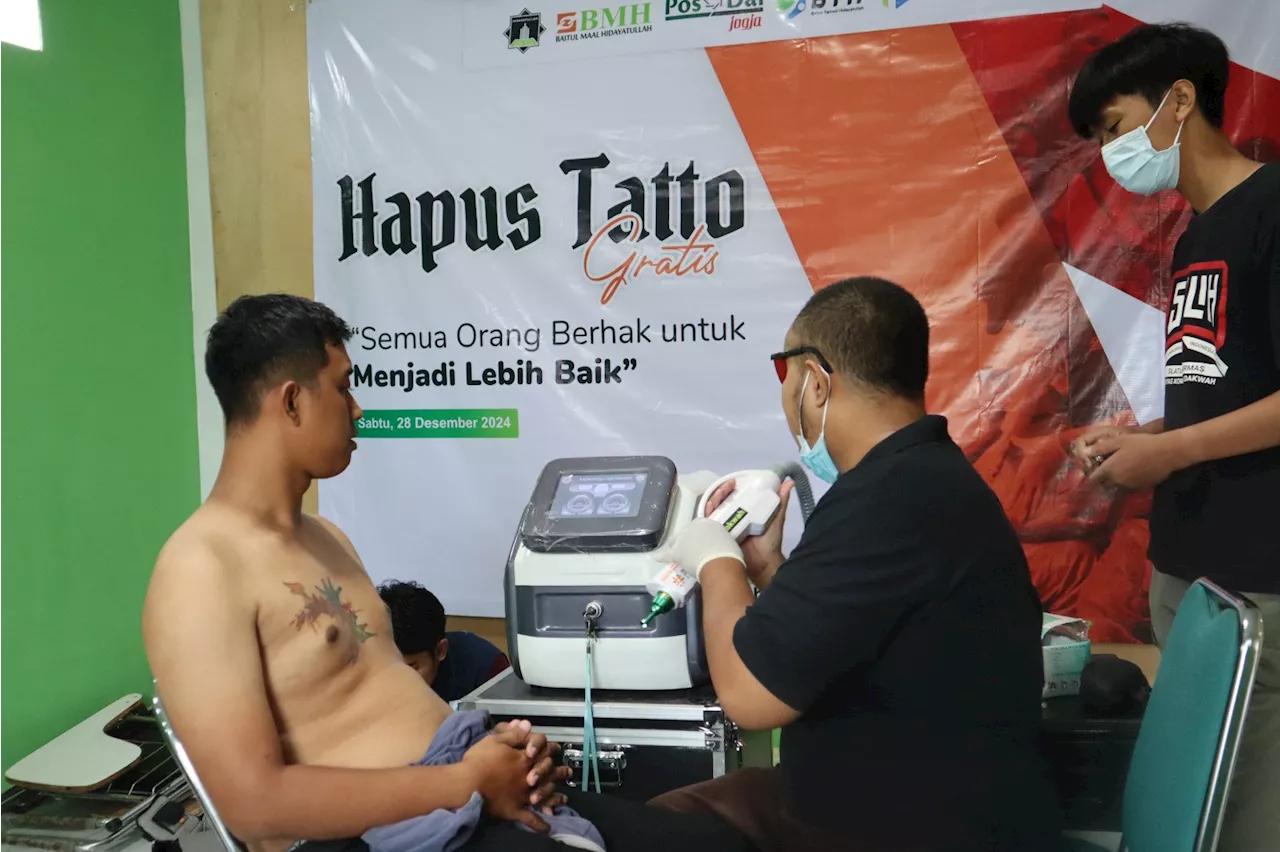 BMH Yogyakarta Sediakan Layanan Hapus Tato untuk Hijrah