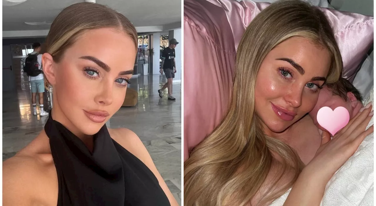 Da Influencer a Denuncia: L'Influencer Ashley Stobart e gli Effetti Collaterali dei Filler