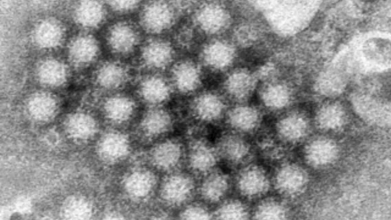 Virus estomacal en aumento en Estados Unidos