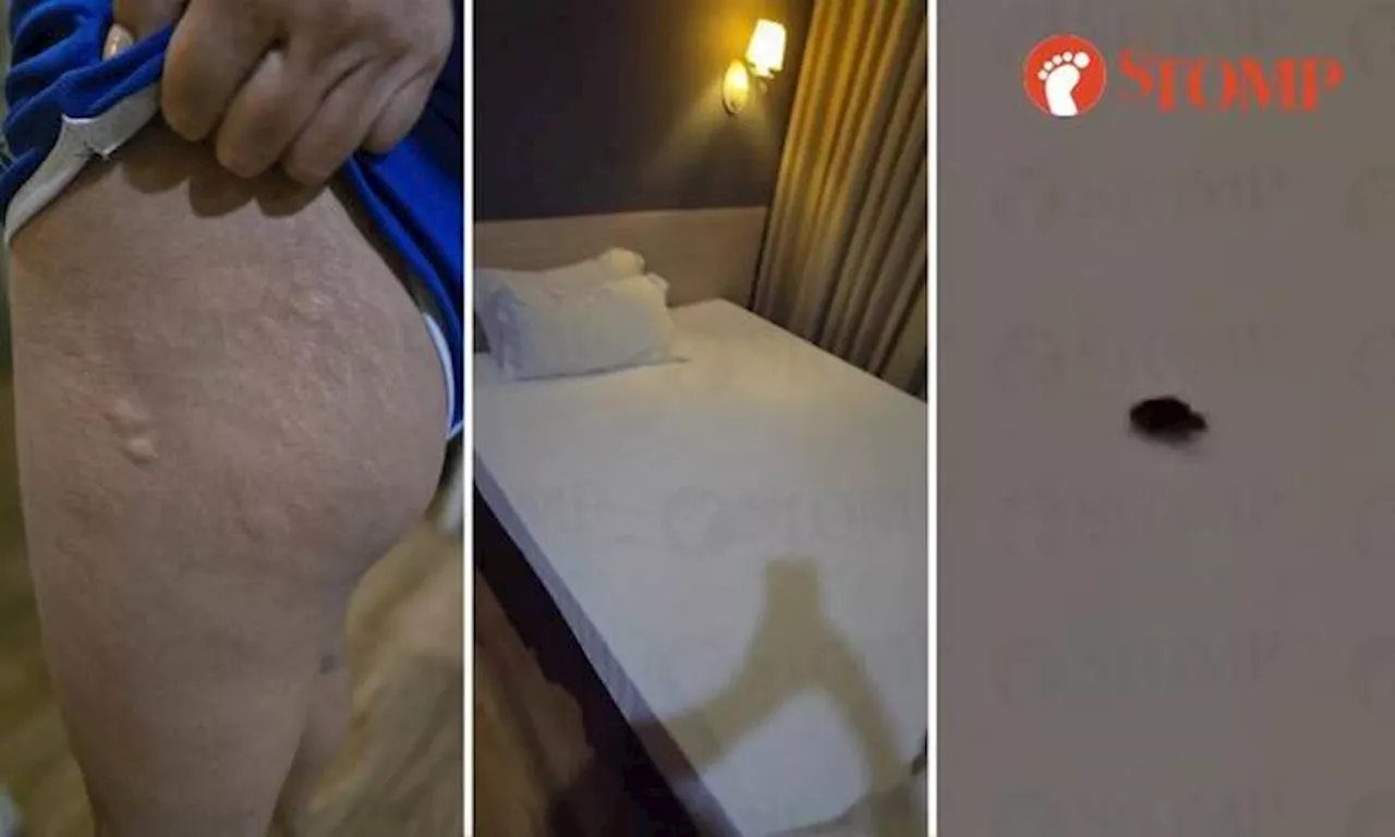 Singaporean Woman Seeks Compensation After Finding Bed Bug in Johor Bahru Hotel