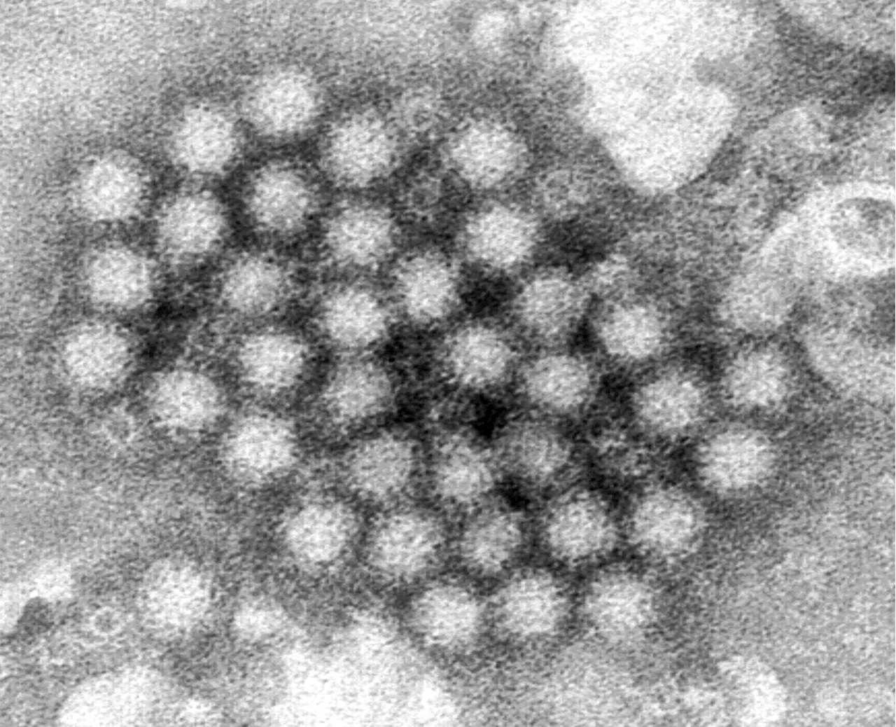 Aumento de casos de norovirus en Estados Unidos durante el invierno