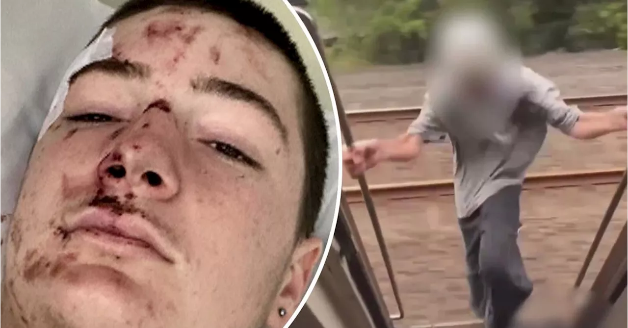 Teenager Nearly Killed Participating in Dangerous Social Media 'Buffer Riding' Trend