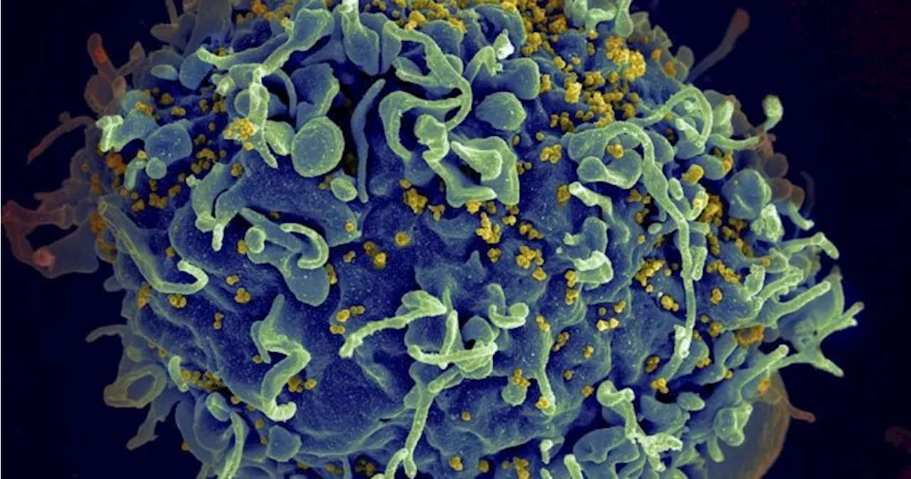 Saskatchewan continues to see highest rate of HIV infection in Canada