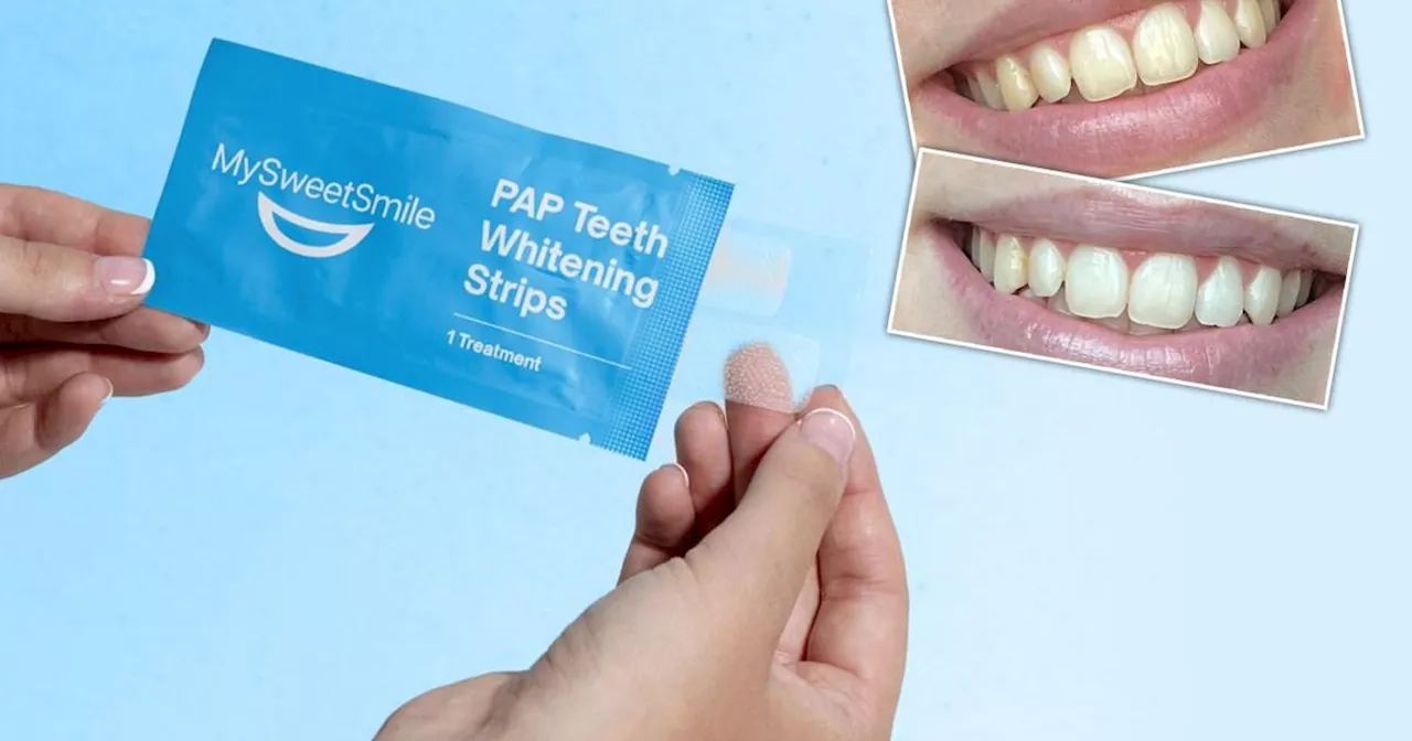 These fast-acting teeth whitening strips are now 25% off