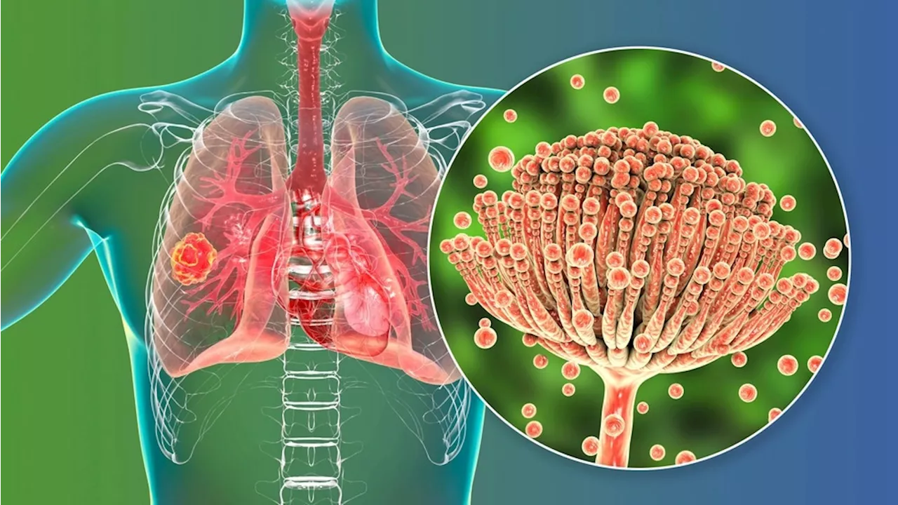 Older Age and Underlying Conditions Increase Mortality Risk in CPA