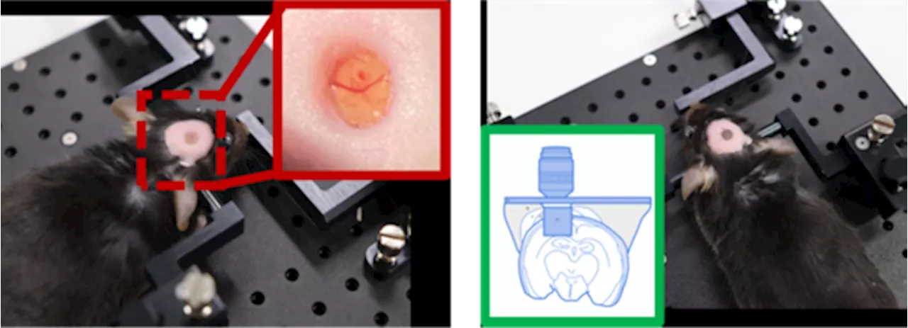 The Power of Two-Photon Microscopy in Intravital Brain Imaging