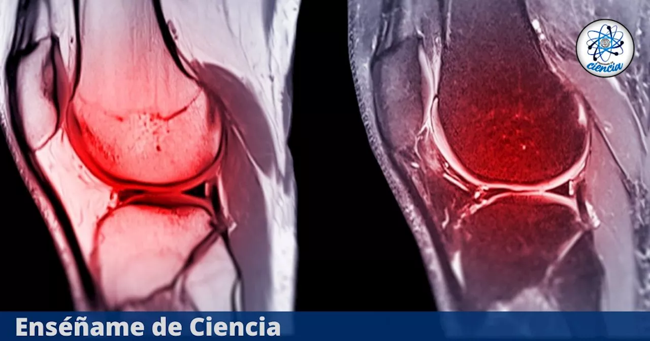 Desarrollan un biomaterial capaz de regenerar por completo el cartílago dañado de las articulaciones