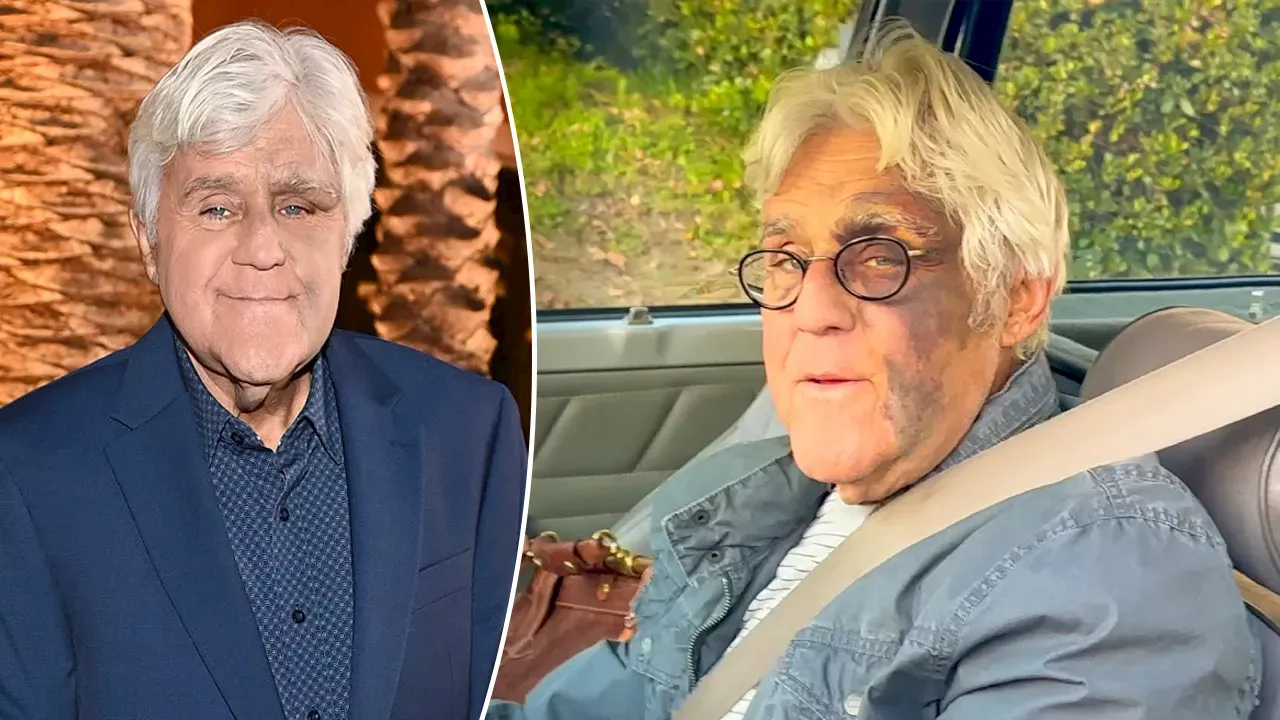 Jay Leno Debunks Mob Rumor After Fall