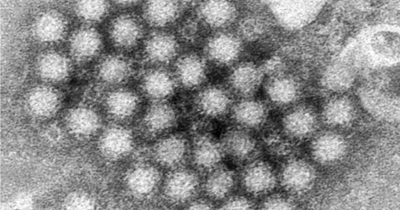 Norovirus Outbreaks: A Public Health Concern