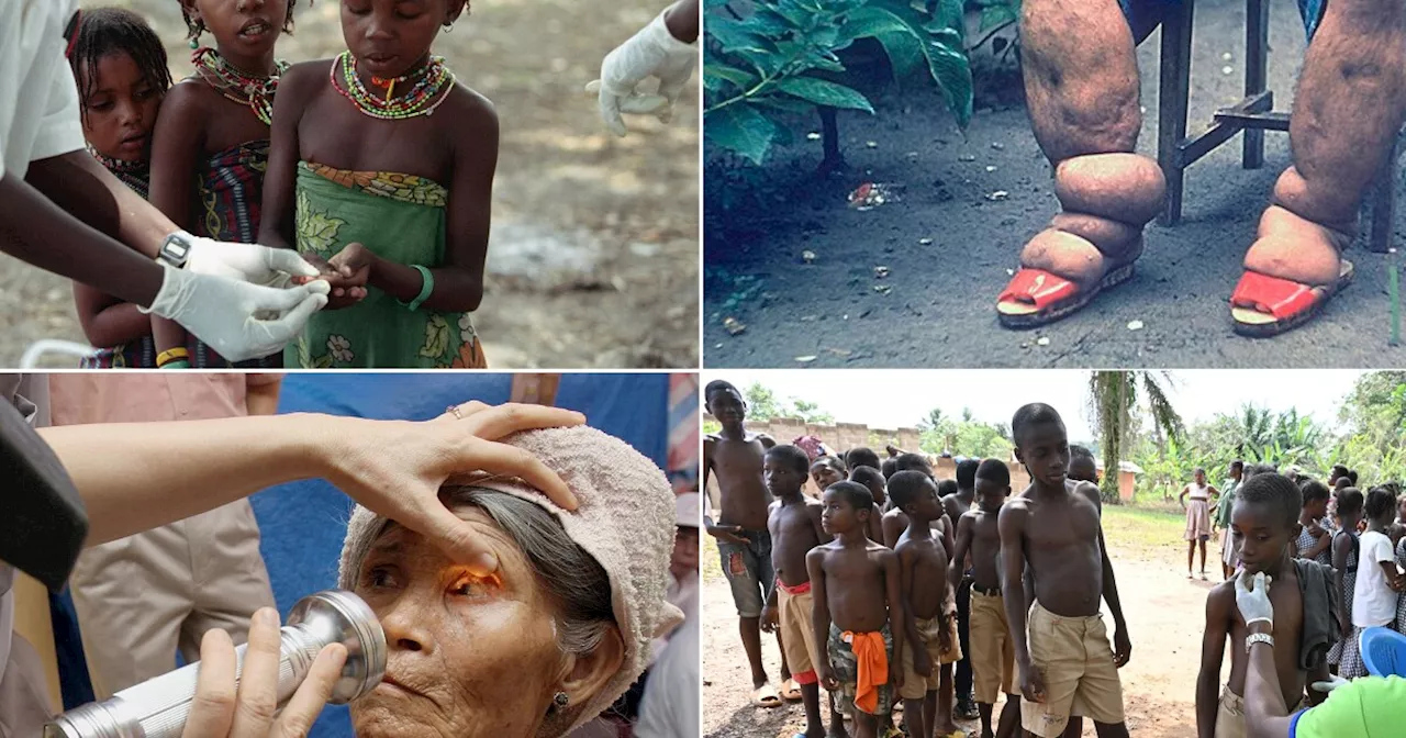 World Celebrates Eliminations of Neglected Tropical Diseases