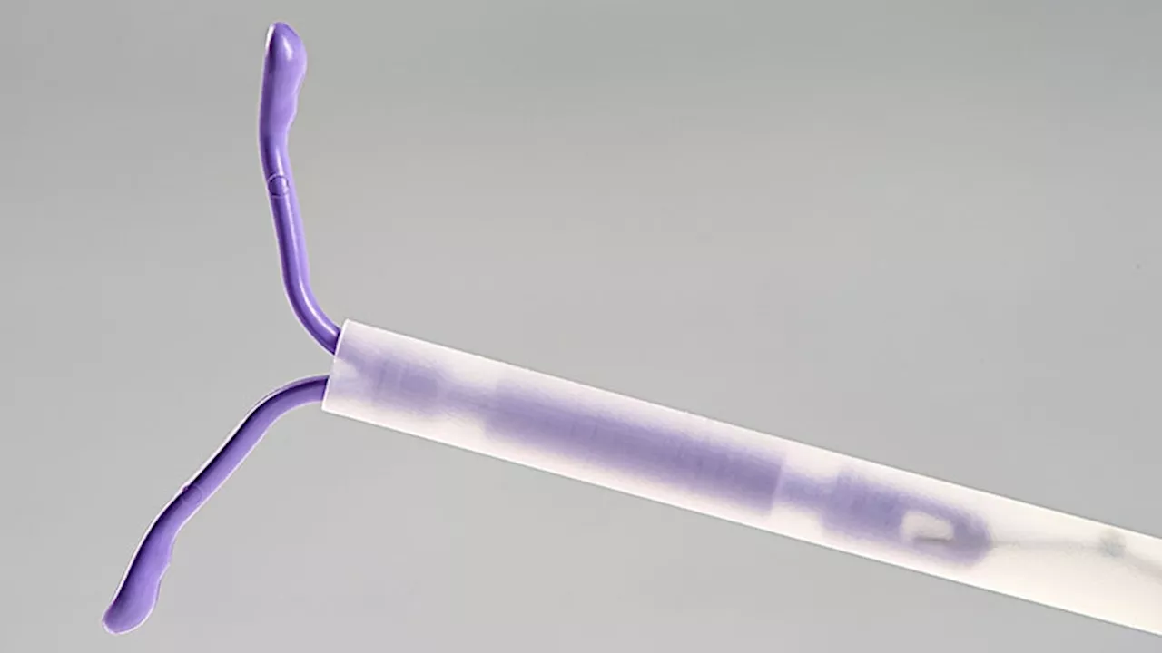 Immediate vs Delayed IUD Placement: Healthcare Utilization Compared