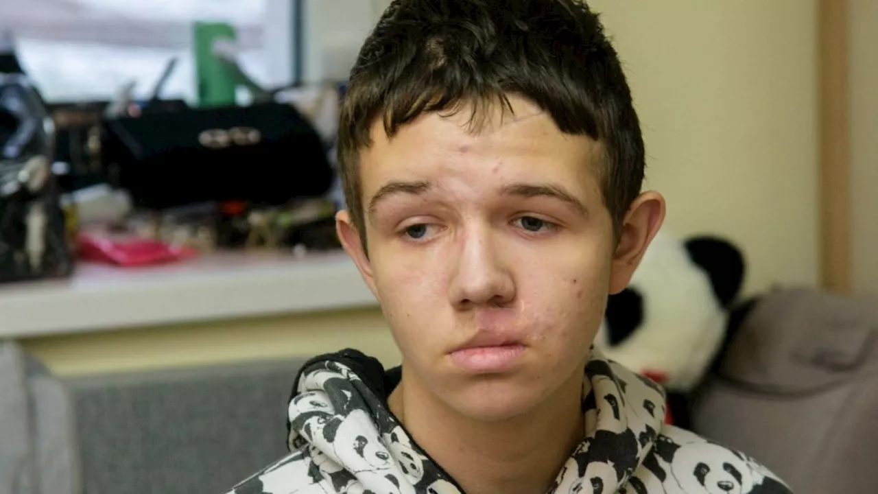 Boy Survives Russian Bomb Attack in Ukraine