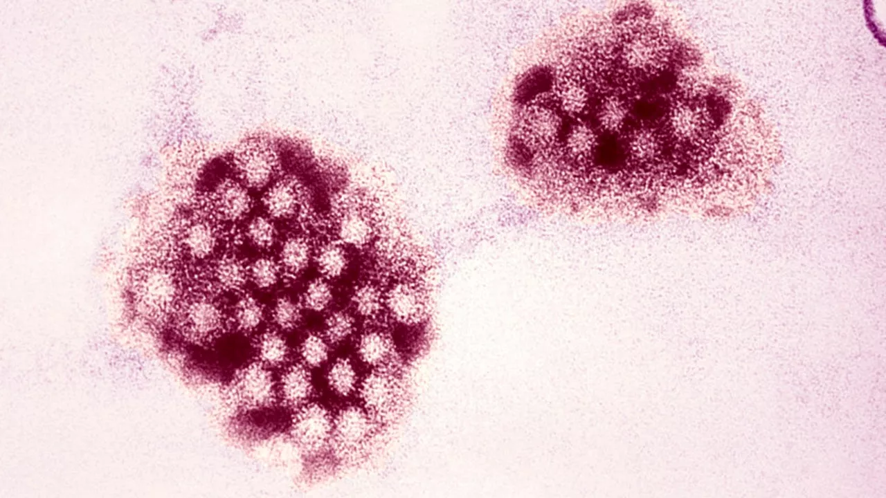 Norovirus Outbreaks Surge Across the US