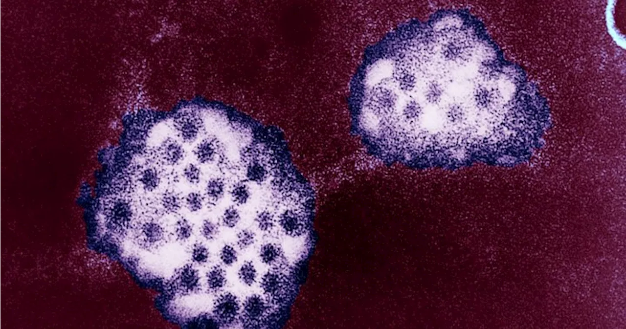 Canada Experiencing Rise in Norovirus Cases