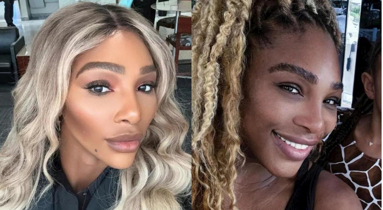 Serena Williams, le accuse: «Si sta sbiancando la pelle come Michael Jackson». E lei risponde a tono