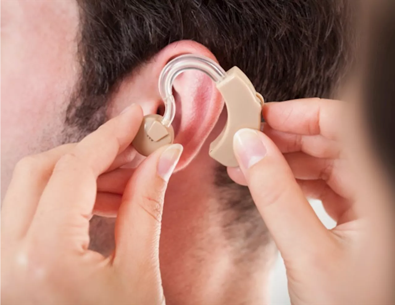 Researchers aim to uncover causes of acquired hearing loss and find potential therapies