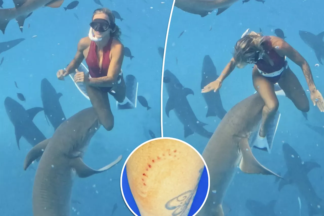 I was bitten by a shark and filmed the whole thing — here's why I'm not complaining