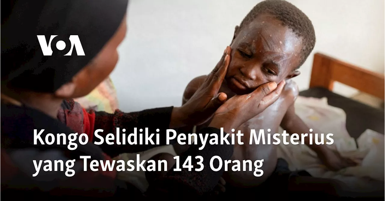 Kongo Selidiki Penyakit Misterius yang Tewaskan 143 Orang