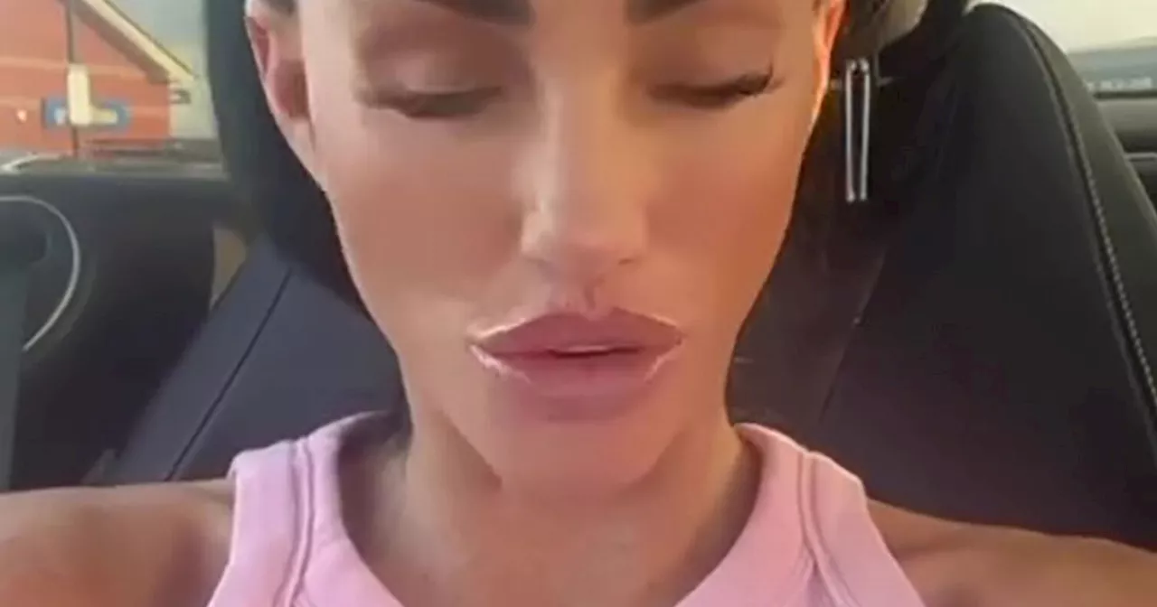 Katie Price Shows Off New Face Post £10,000 Facelift, Fans Divided