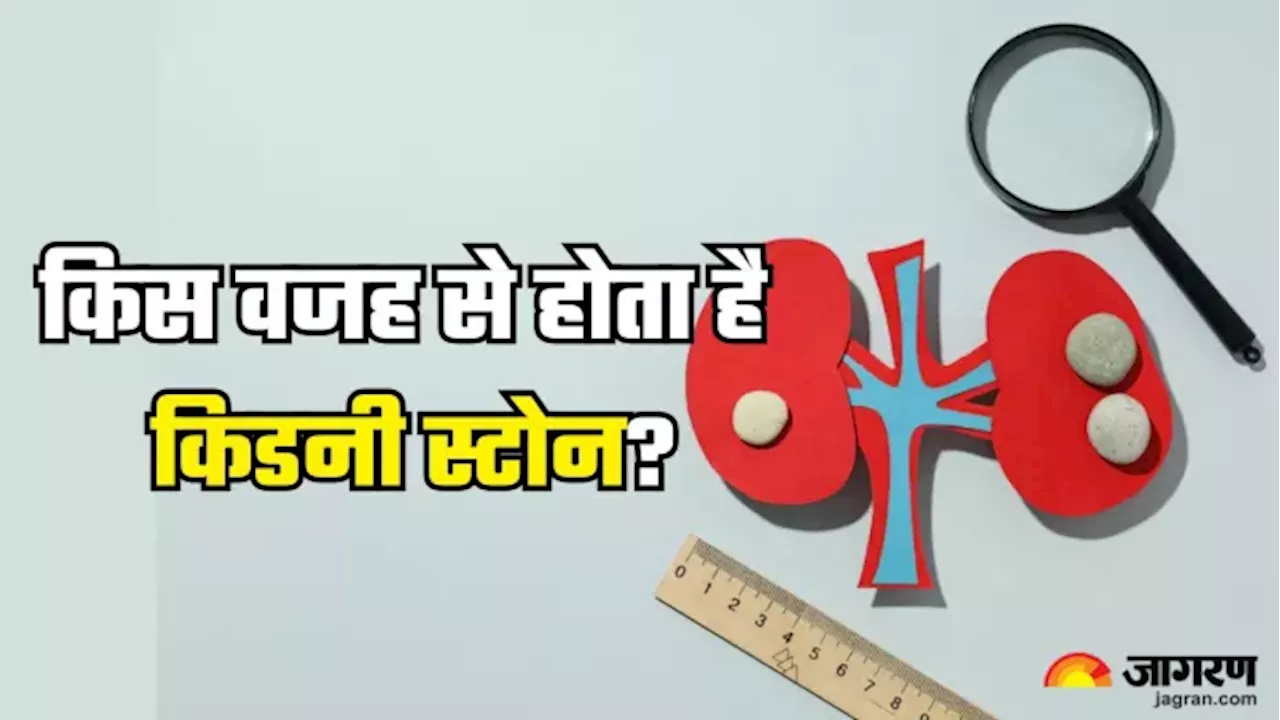 आपकी रोज की छोटी-छोटी आदतें बढ़ाती है Kidney Stone का खतरा, इन तरीकों से करें बचाव