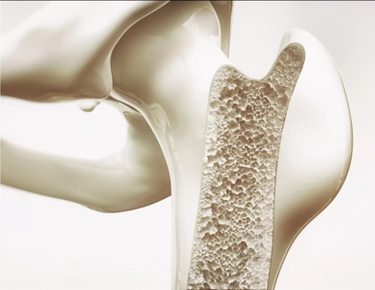 Coral-inspired bone graft could transform treatment for bone defects