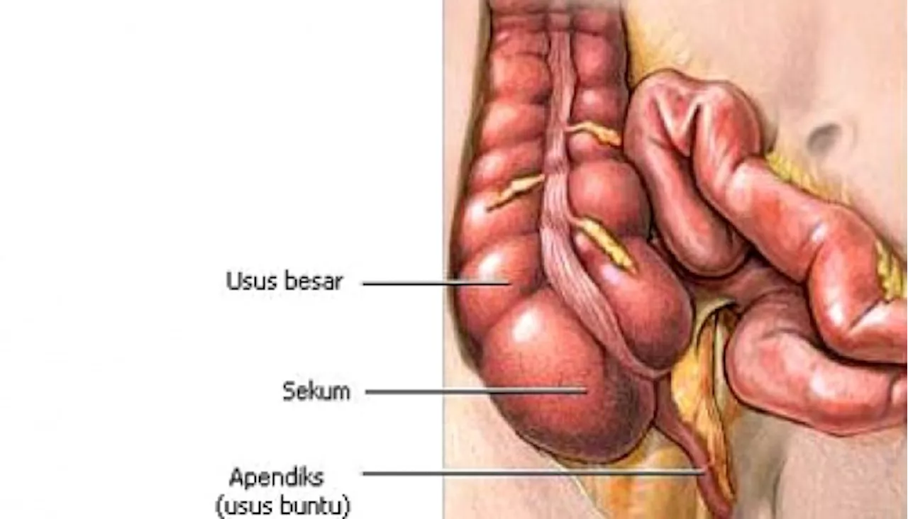 Apa itu Penyakit Radang Usus dan Siapa Saja yang Paling Berisiko Mengalami?