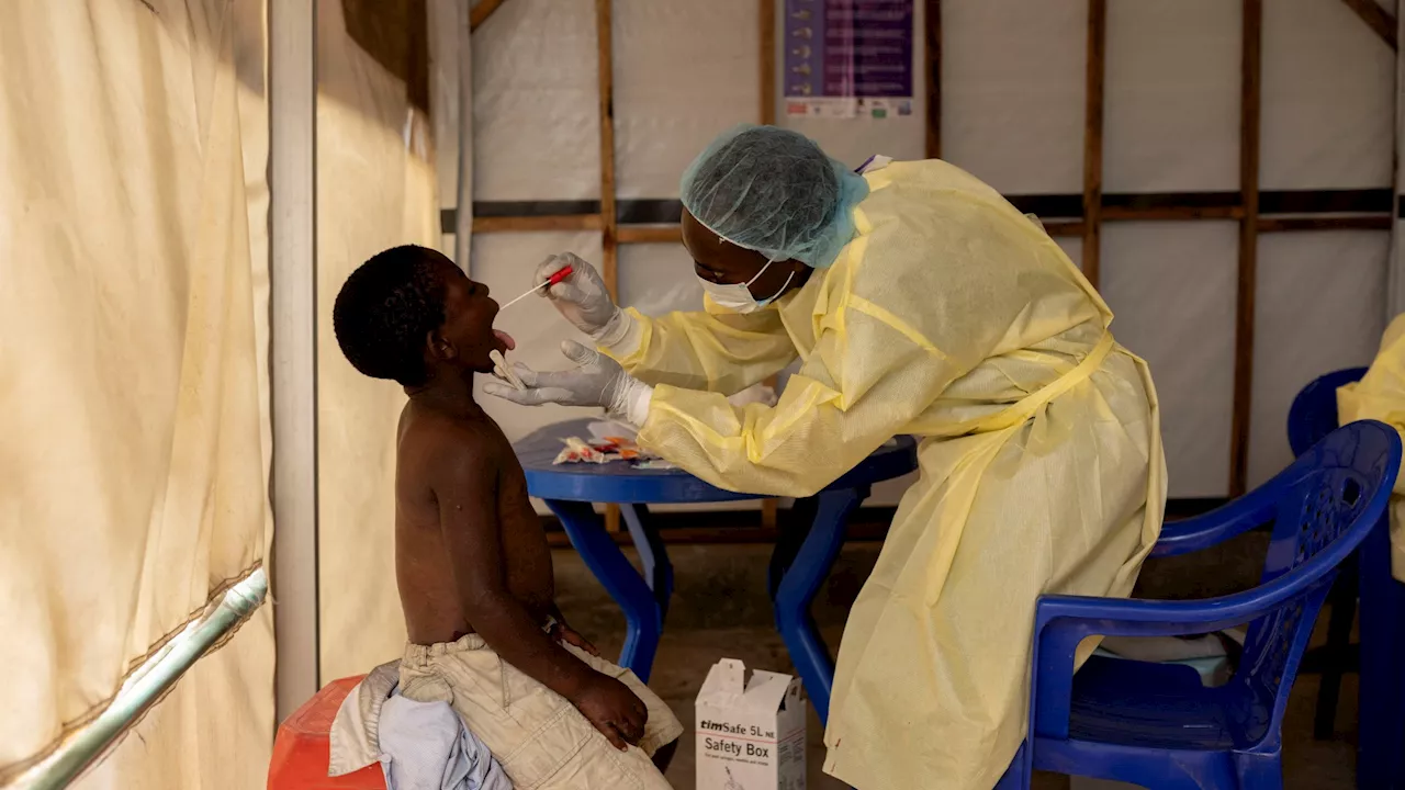 Mystery Flu-Like Disease Claims 71 Lives in Congo