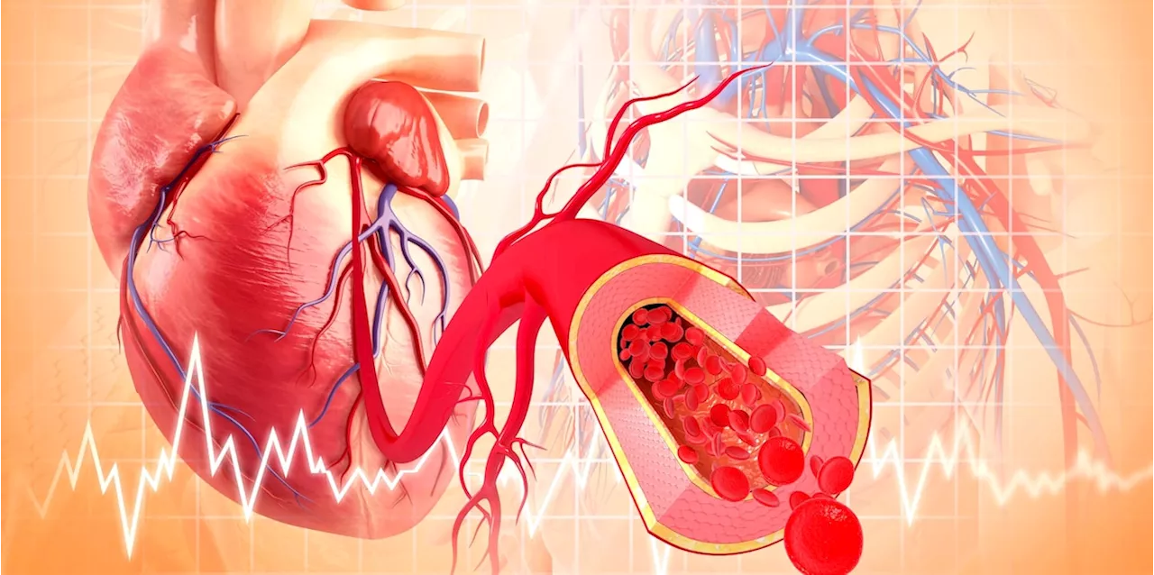 Debatte um Cholesterinsenker: Arzt erklärt, wem sie wirklich nutzen