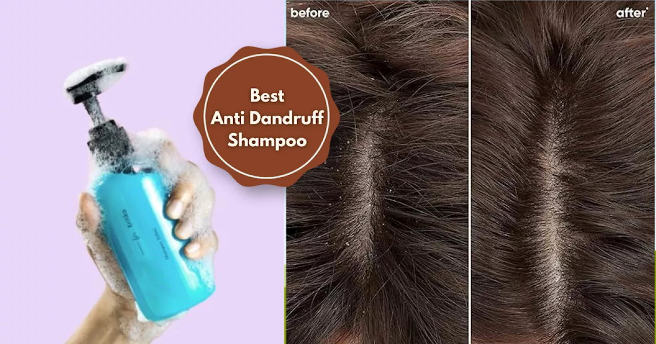 इन Anti Dandruff Shampoo से सर्दियों में बढ़ रही बालों की रूसी जप जाएगी छूमंतर, वार्डरॉब रिफ्रेश सेल में पाएं धाकड़ छूट