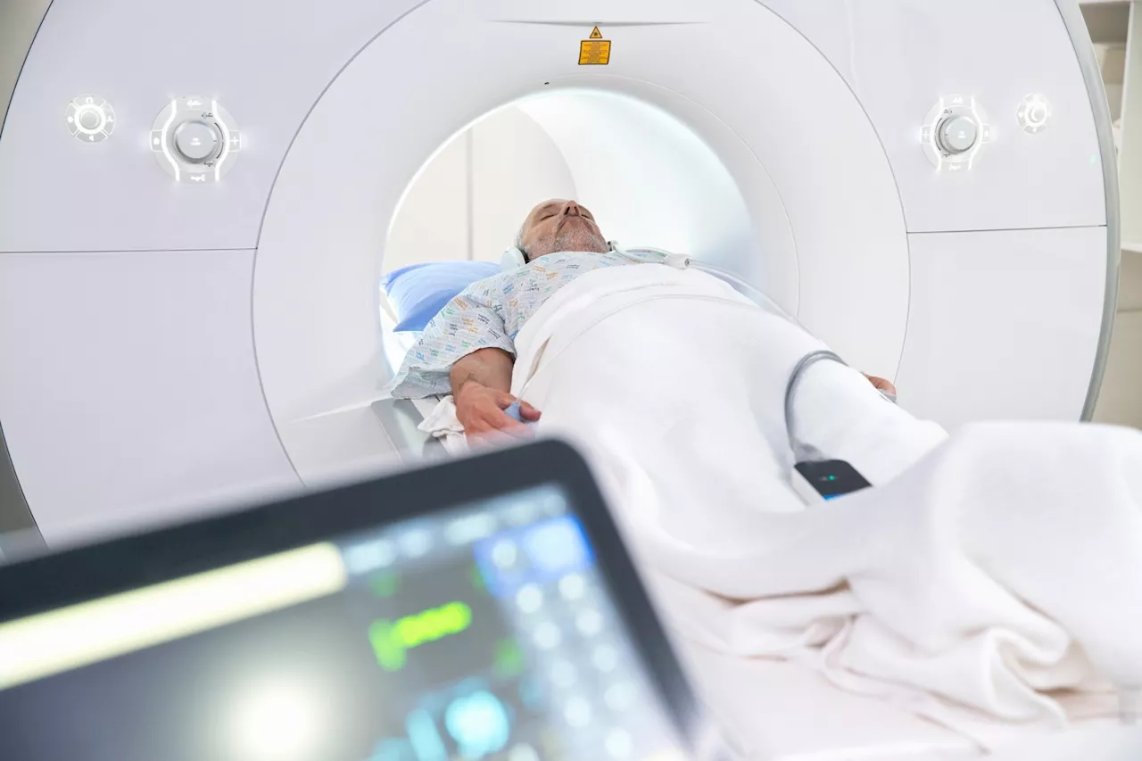 AI predicts mortality with whole-body MRI for personalized health insights