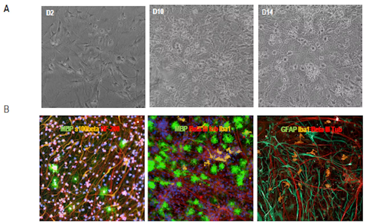 How to create an iPSC-derived in vitro model to study neuroinflammation