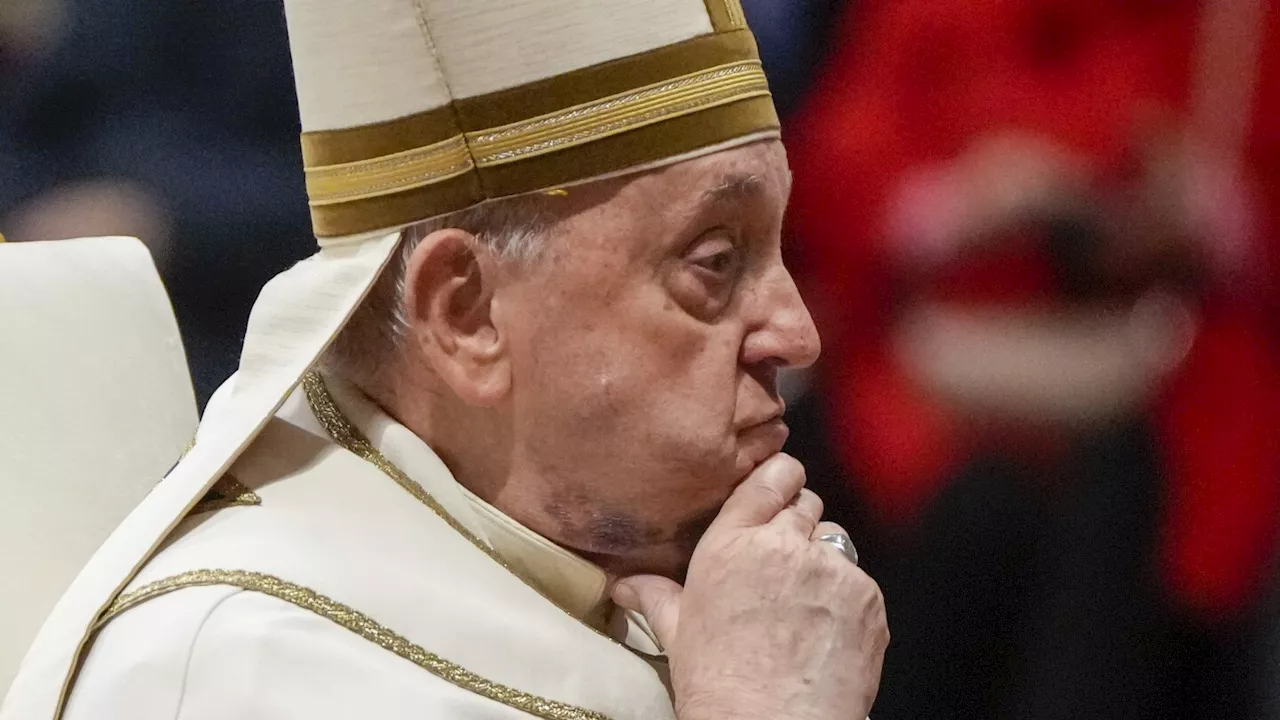 Pope Francis presides over ceremony for new cardinals with wide bruise on his chin