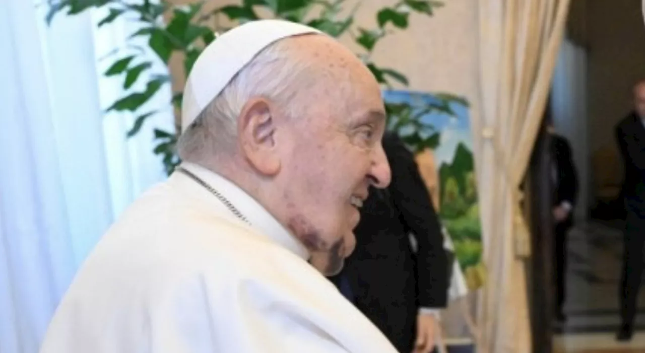 Papa Francesco con un grande livido sotto il mento, a San Pietro ecco i 21 nuovi cardinali