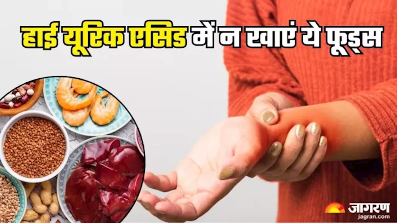 High Uric Acid की समस्या को बदतर बना सकते हैं ये फूड्स, भूलकर भी न करें खाने की गलती