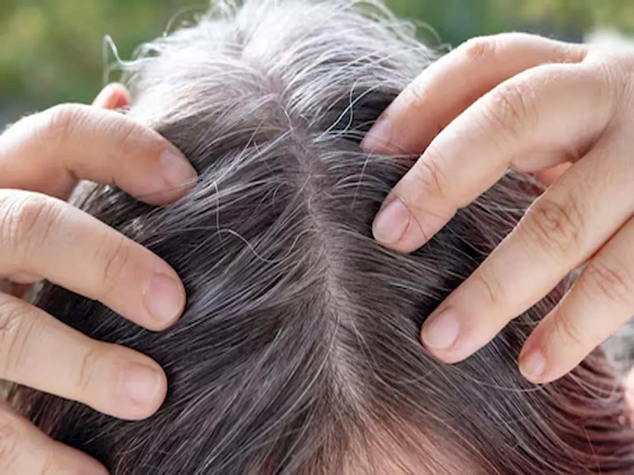 White Hair: નાળિયેર તેલમાં 4 વસ્તુ મિક્સ કરી ઘરે જ બનાવો નેચરલ હેર ડાઈ, 15 મિનિટમાં મૂળમાંથી કાળા થઈ જશે સફેદ વાળ