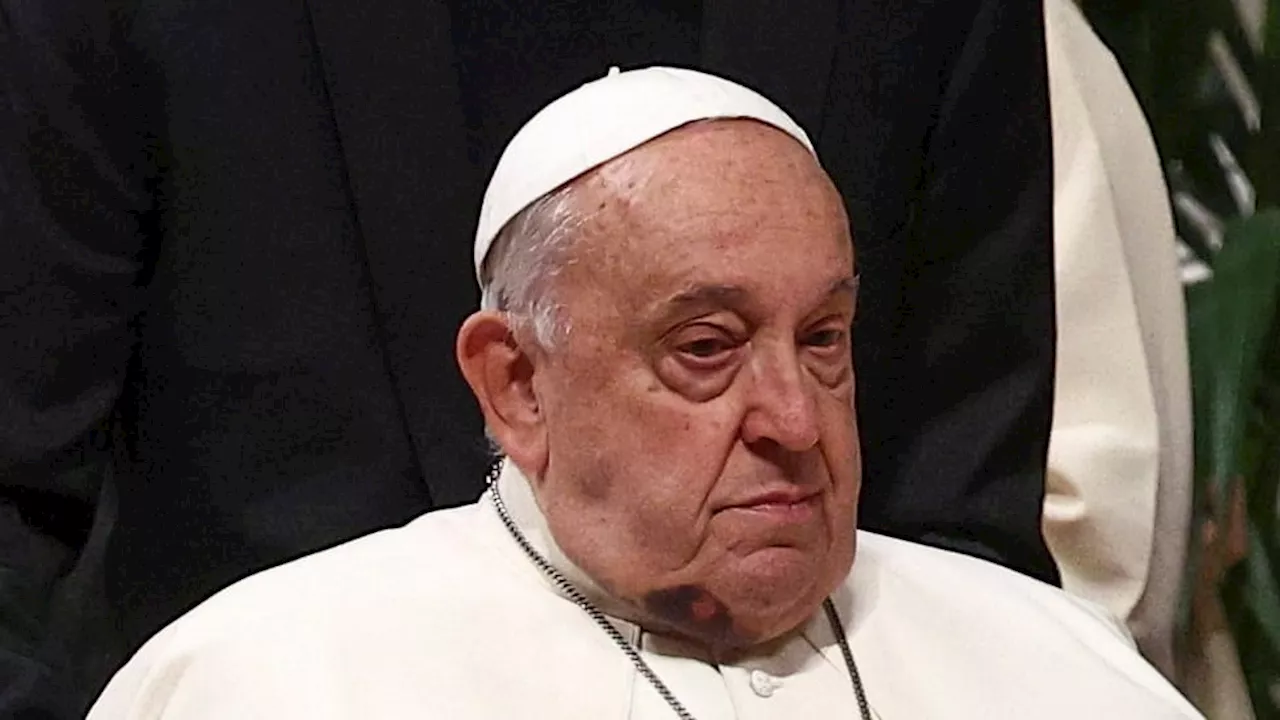 Papst Franziskus mit blauem Fleck an Hals und Kinn