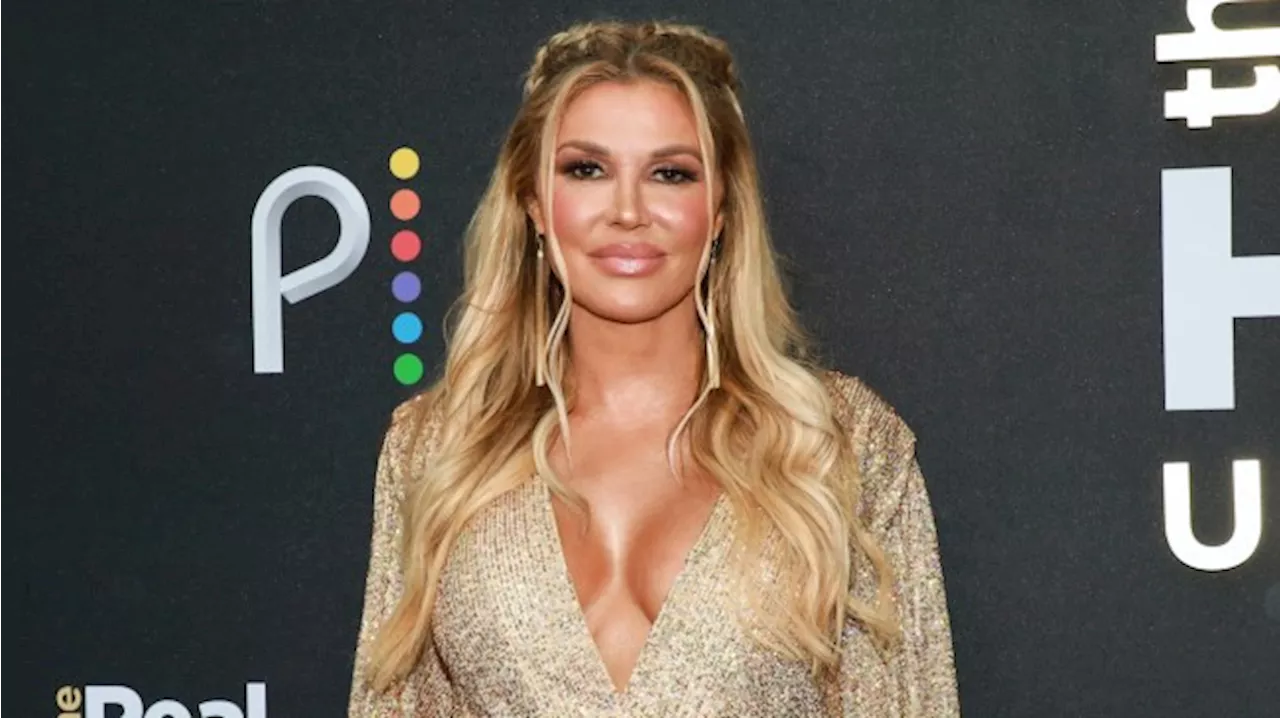 What Happened to Brandi Glanville's Face? RHOBH Star's Condition