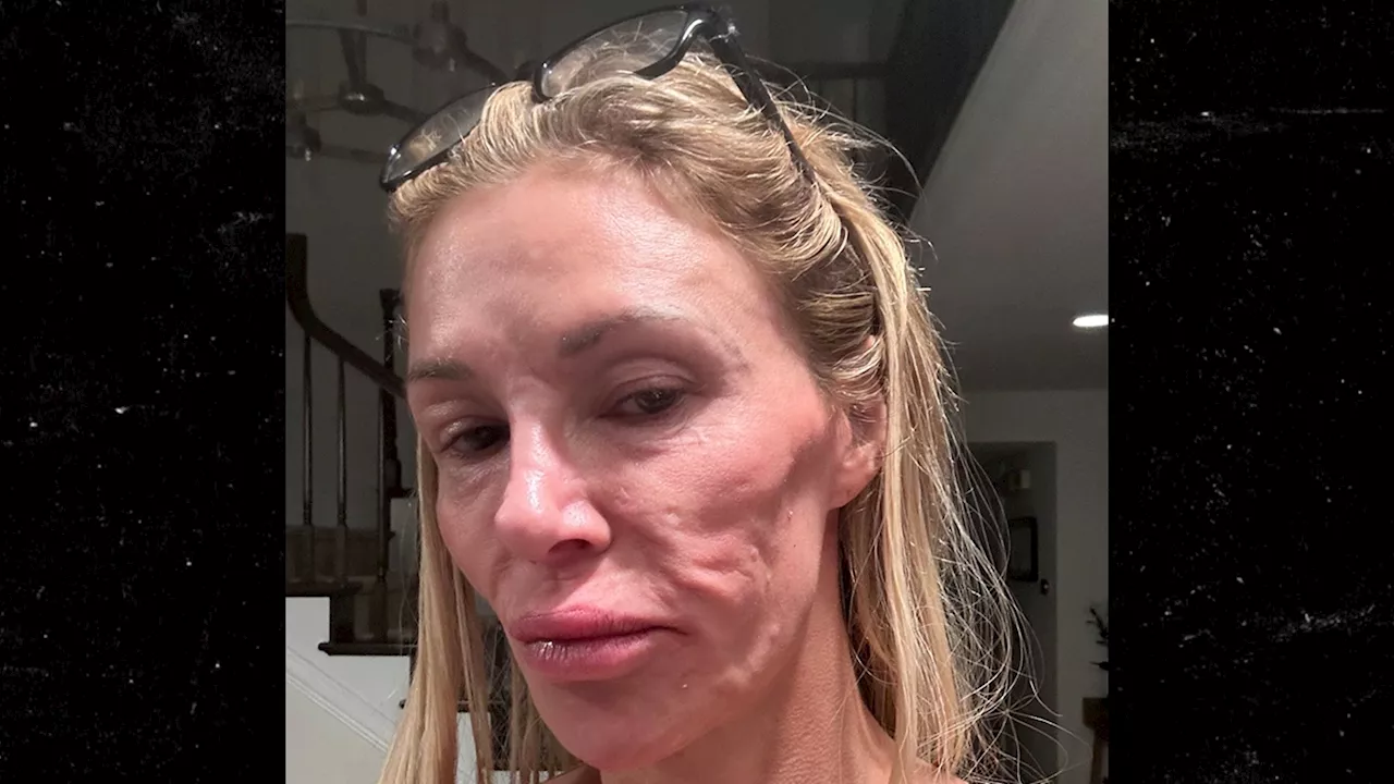 Brandi Glanville Sparks Concern With New Selfie on Social Media