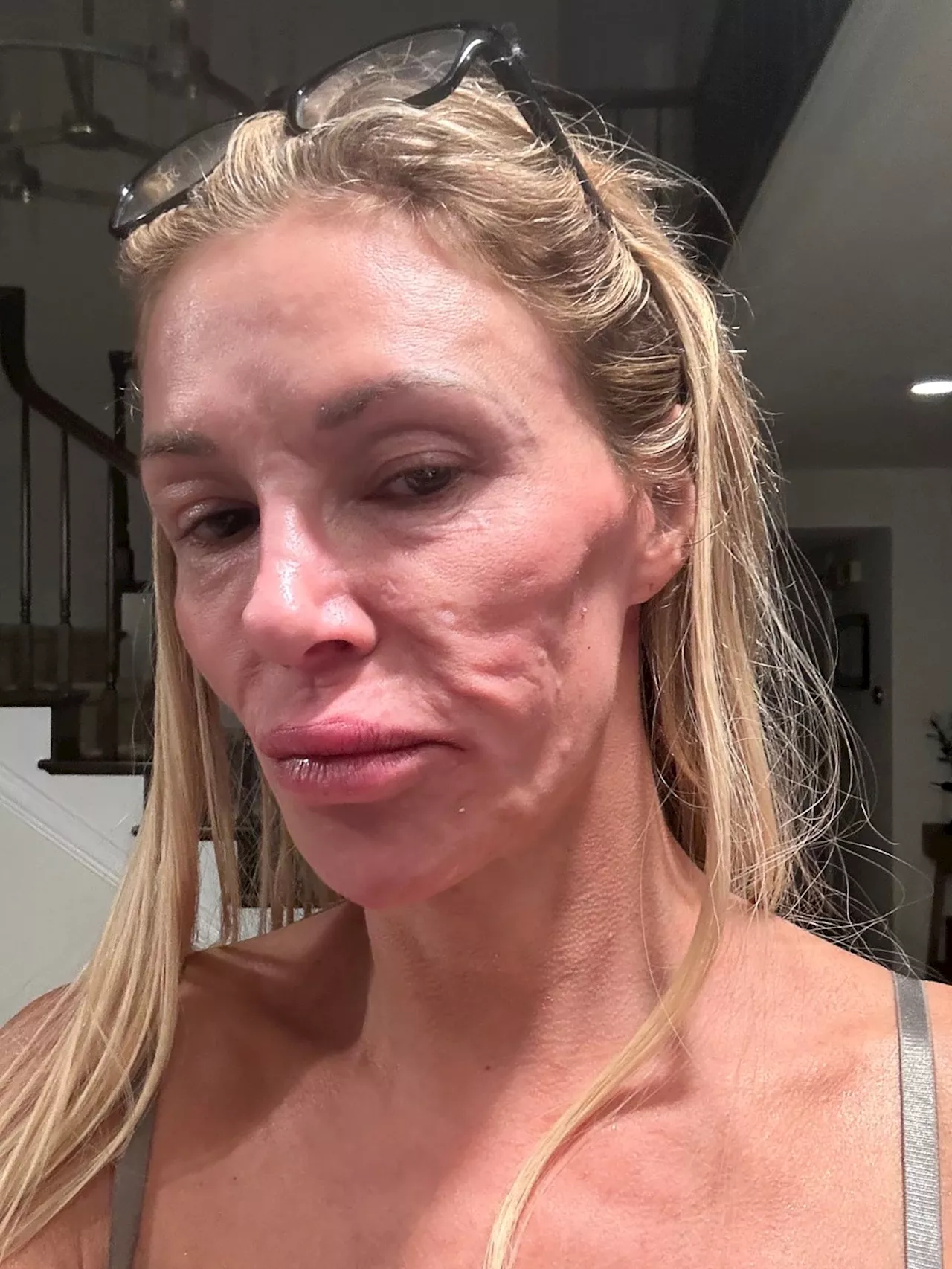 Brandi Glanville Shares Selfie Amid Ongoing Health Issues