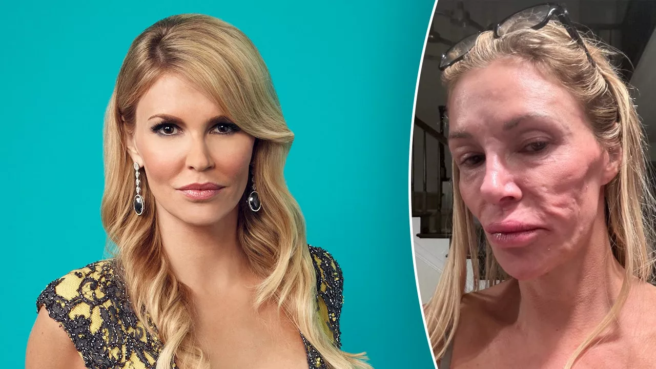 Brandi Glanville shares stripped down photo as she claims her 'looks are ruined' by mystery illness