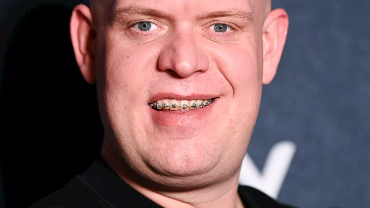 Michael van Gerwen before and after explained as darts champion endures year of dental surgery...