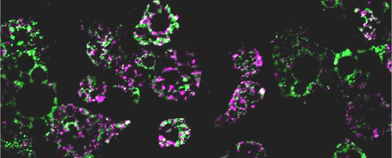 Obesity Disrupts Mitochondria, And We May Have Figured Out How