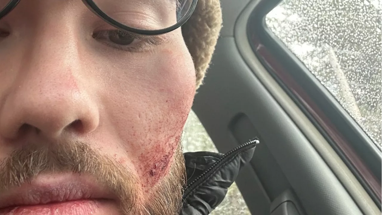 'Punching for my life': Calgary man recounts cougar attack in Banff National Park