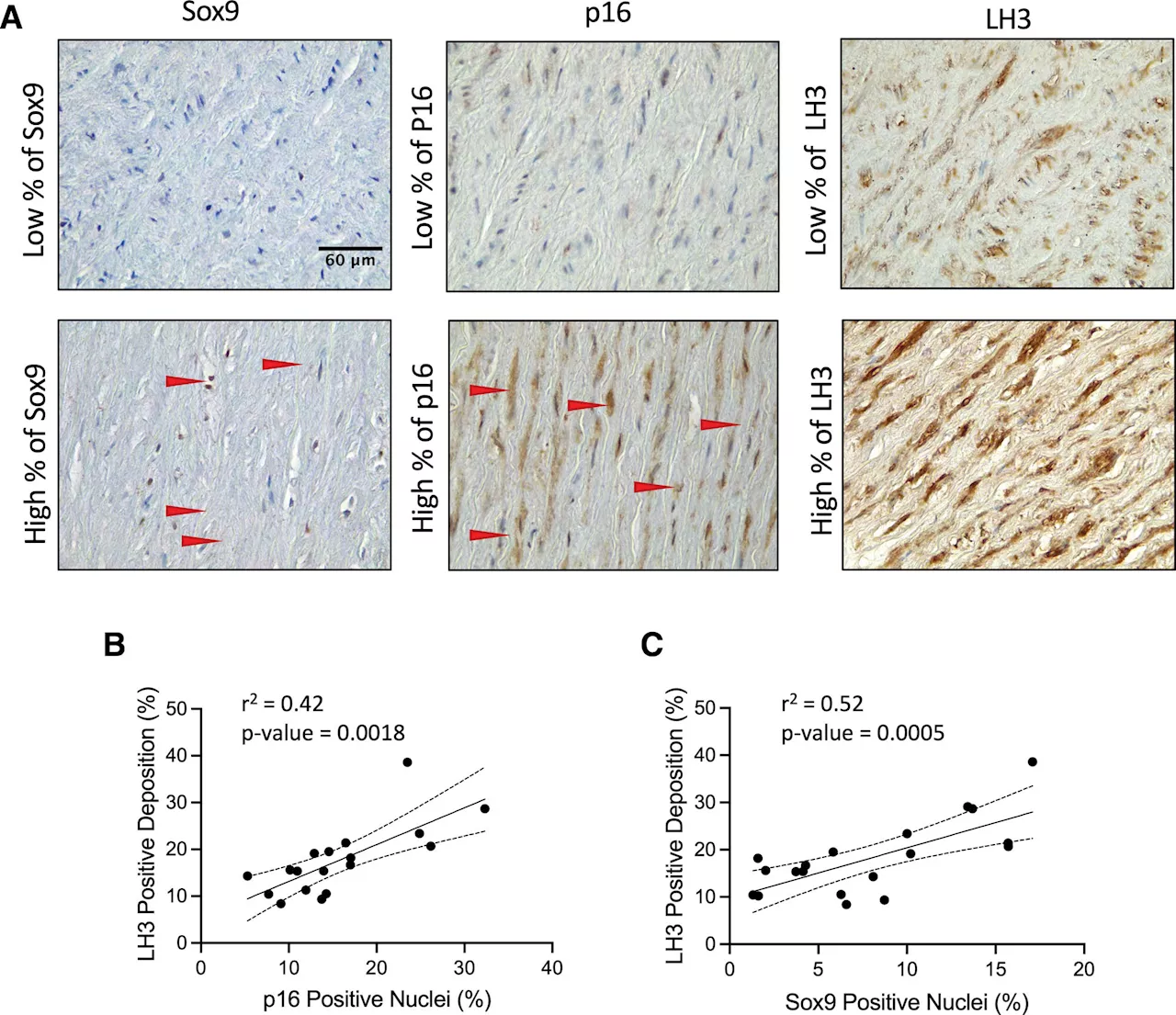 Researchers uncover key molecule influencing vascular aging