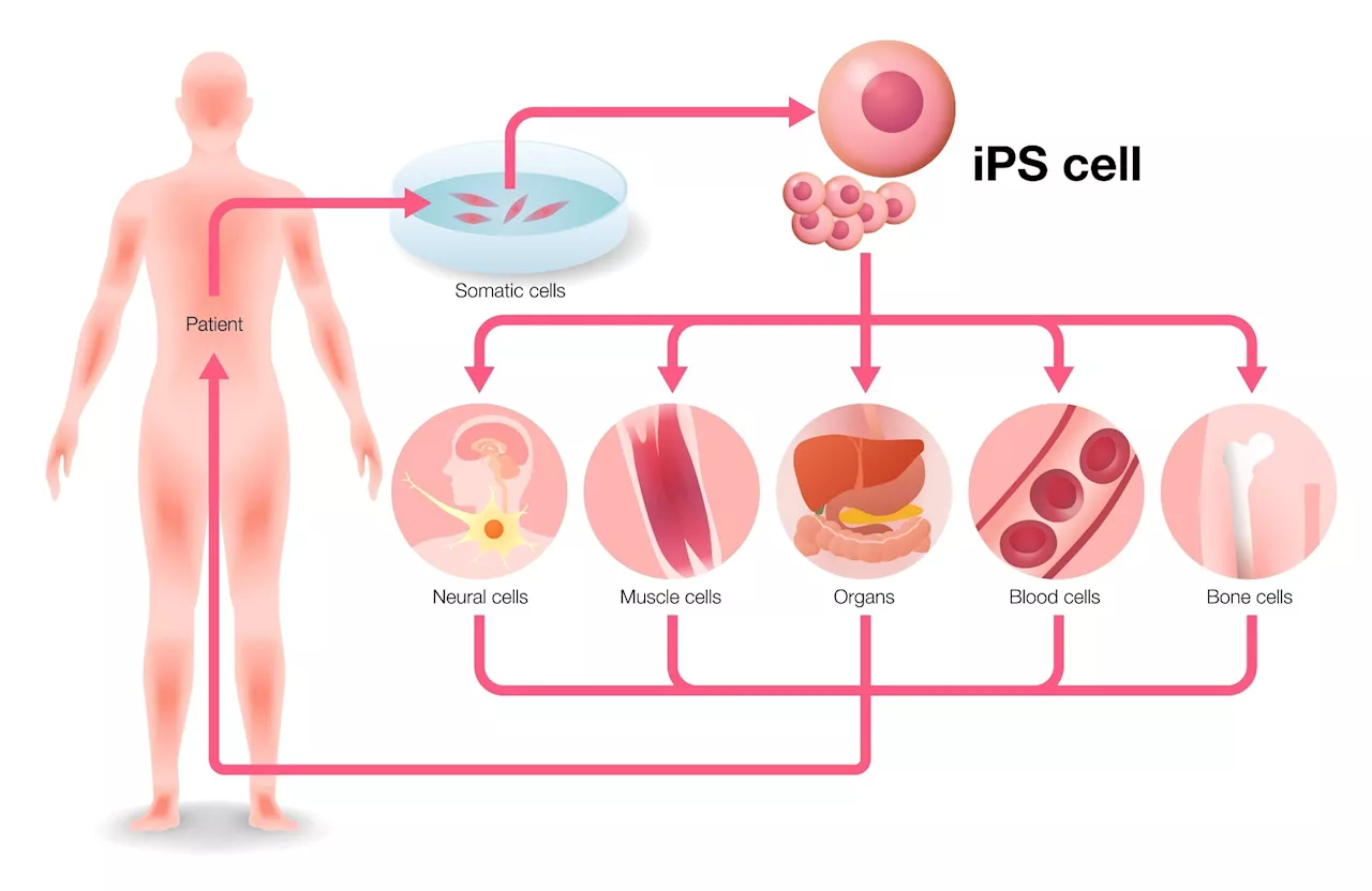 Breaking through new research barriers with iPSC technology