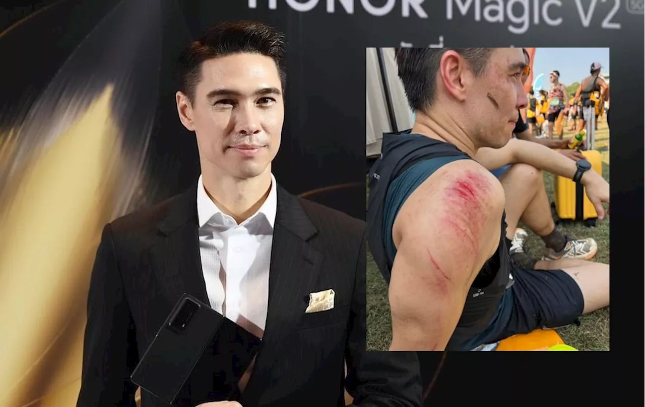 'แมทธิว' ประสบอุบัติเหตุ ขณะไปวิ่งเทรล
