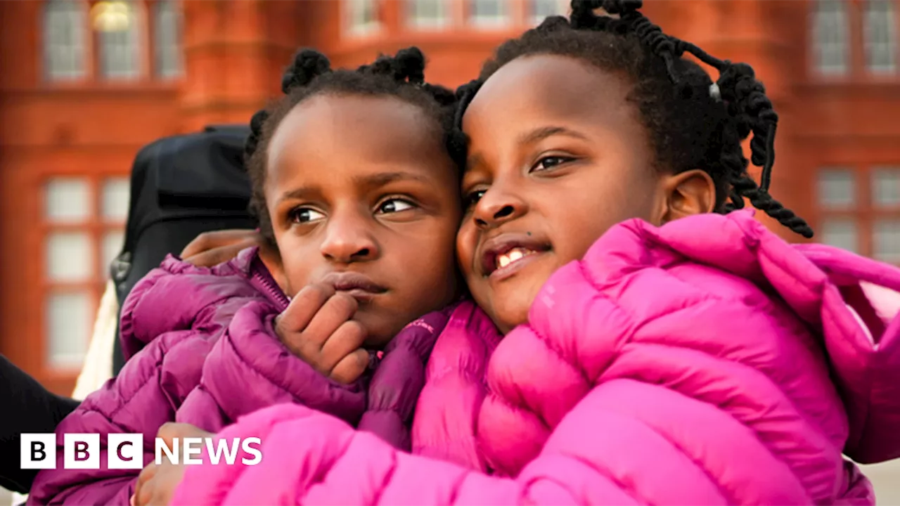 Conjoined twins given days to live are proving everyone wrong