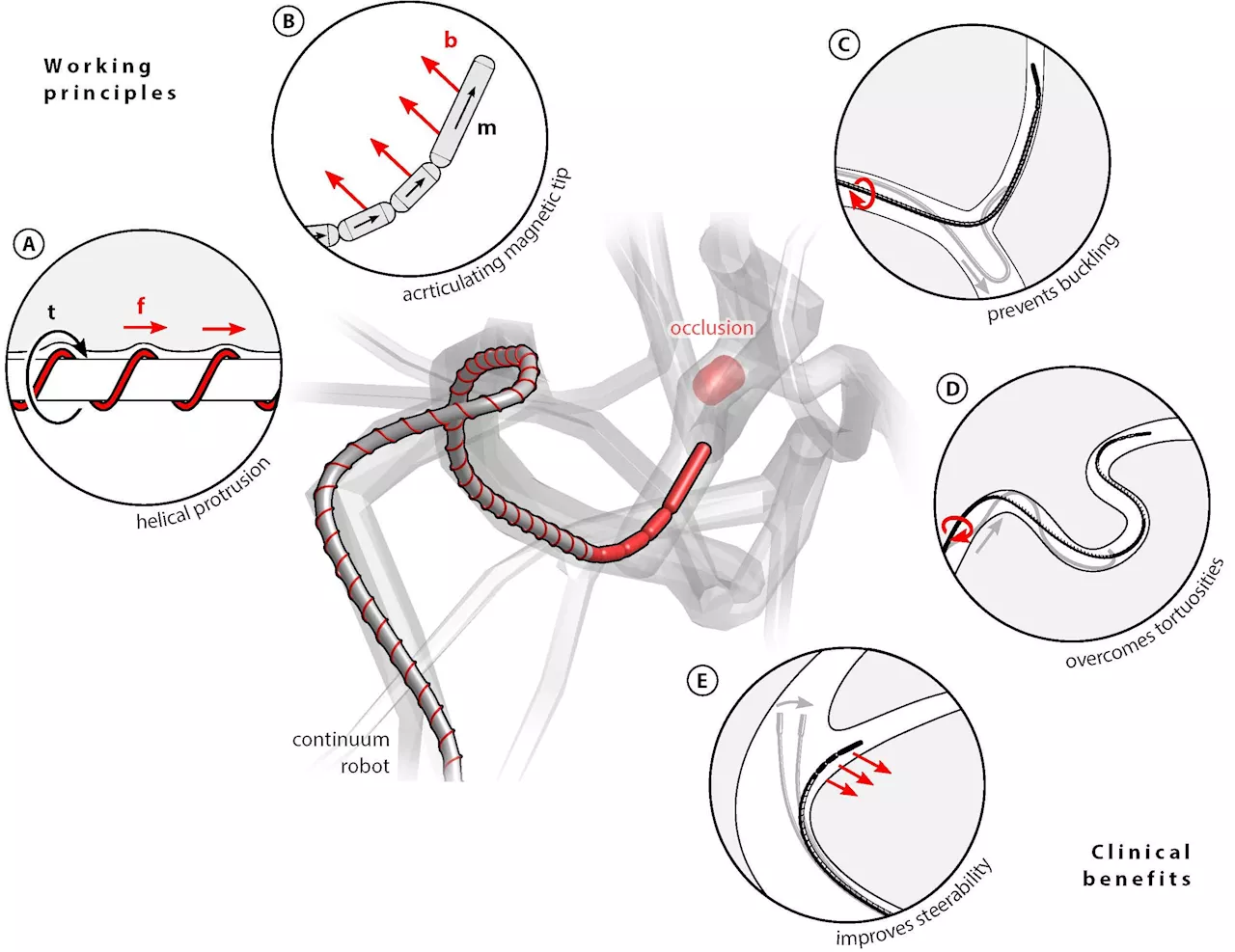 Magnetically operated robot can move through arteries to treat stroke patients