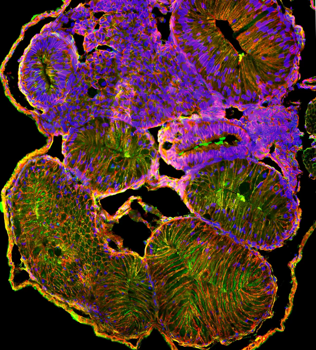 Frog embryo study helps scientists unravel the human birth anomaly of intestinal malrotation